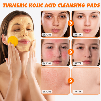 🔥Last Day Big Discount Promotion🔥 | Prionne Turmeric Kojic Glow Pads