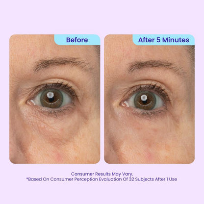 💜 Instant Eye Lift for a Fresh, Awake Look✨