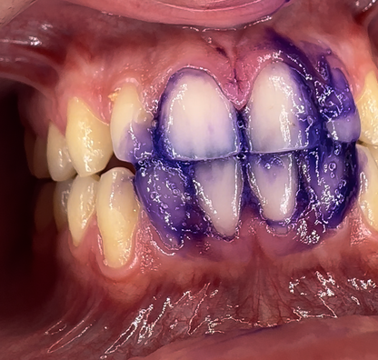 🦷 Lumirevynx Helps Your Smile Look More Balanced, More Radiant, and More Polished 🌈