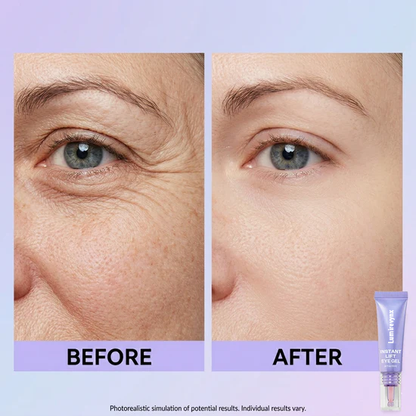 💜 Instant Eye Lift for a Fresh, Awake Look✨