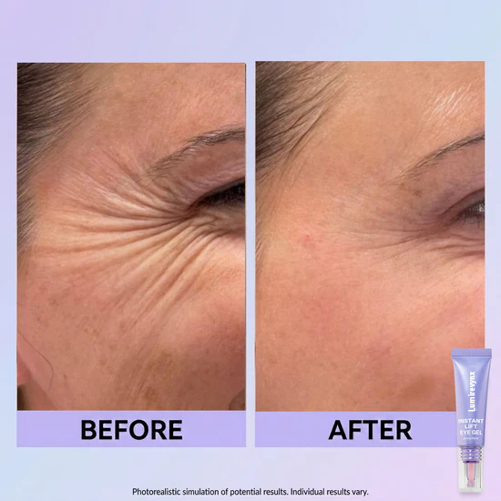 💜 Instant Eye Lift for a Fresh, Awake Look✨