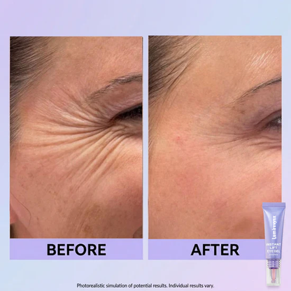 💜 Instant Eye Lift for a Fresh, Awake Look✨