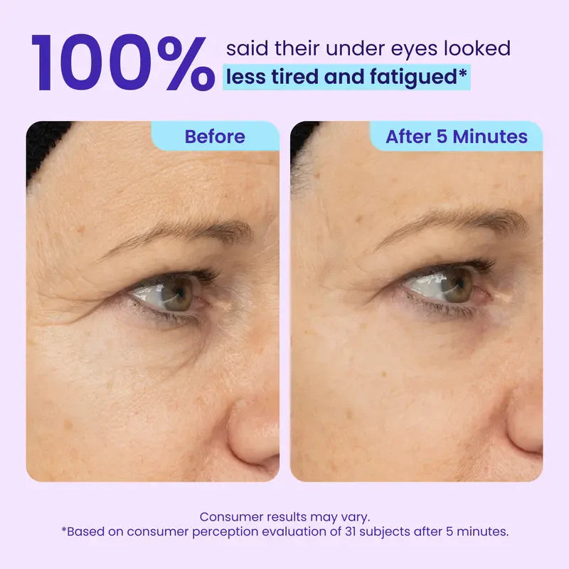 💜 Instant Eye Lift for a Fresh, Awake Look✨