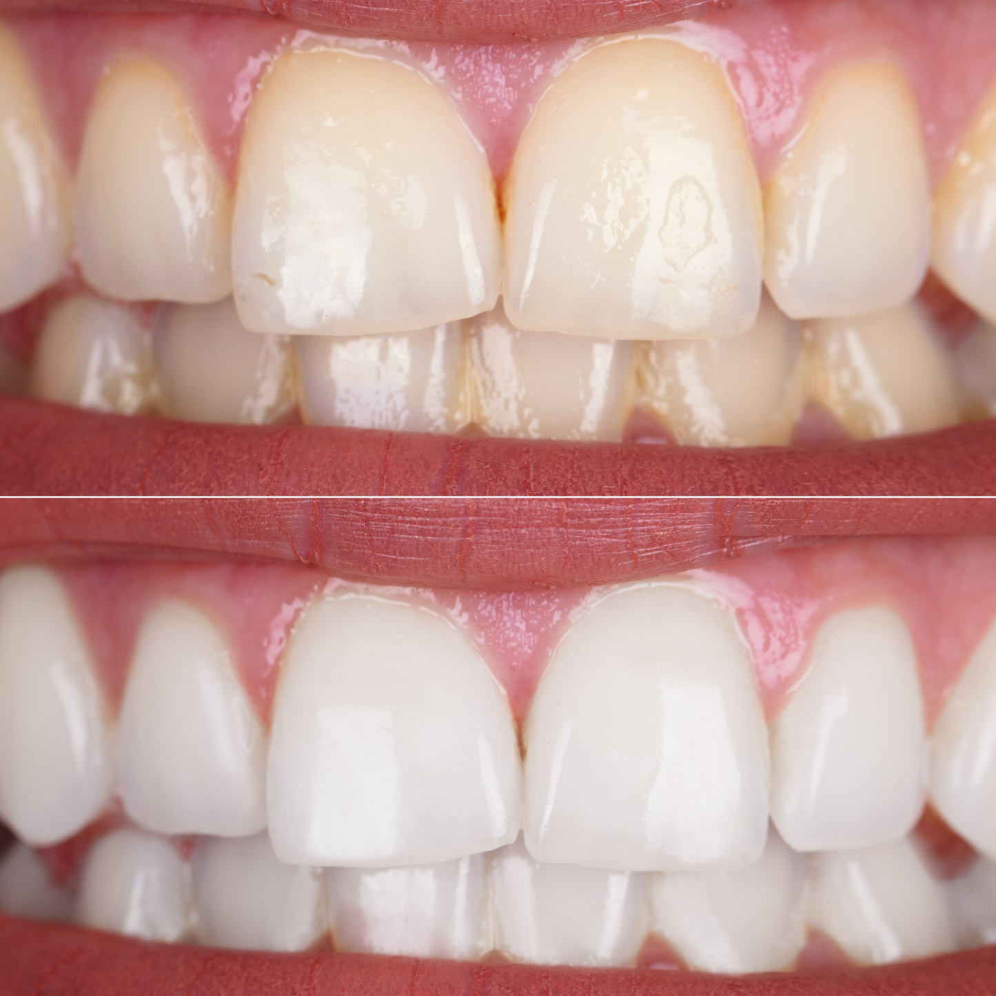 🦷 Lumirevynx Helps Your Smile Look More Balanced, More Radiant, and More Polished 🌈