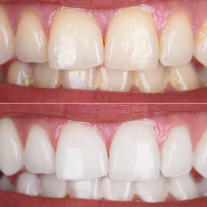 🦷 Lumirevynx Helps Your Smile Look More Balanced, More Radiant, and More Polished 🌈